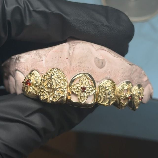 Grill Impression Consultation