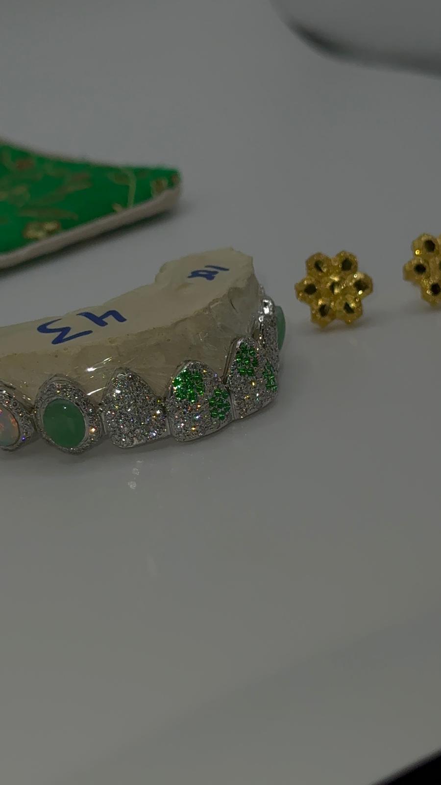 Grill Impression Consultation